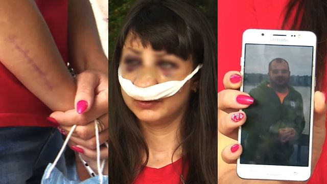 Погрожував вбити доньку і казав, що любить: подробиці побиття жінки в Запоріжжі