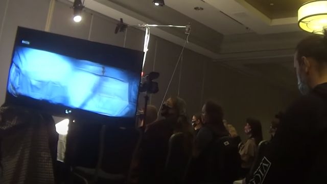 розтин тіла