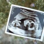 В Британии успешно применили новаторскую методику ЭКО: в чем суть прорыва