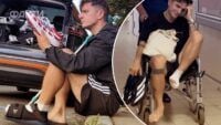 Анатолій Анатоліч зламав пальці на нозі