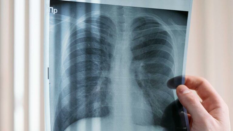 тест на здоров'я легень