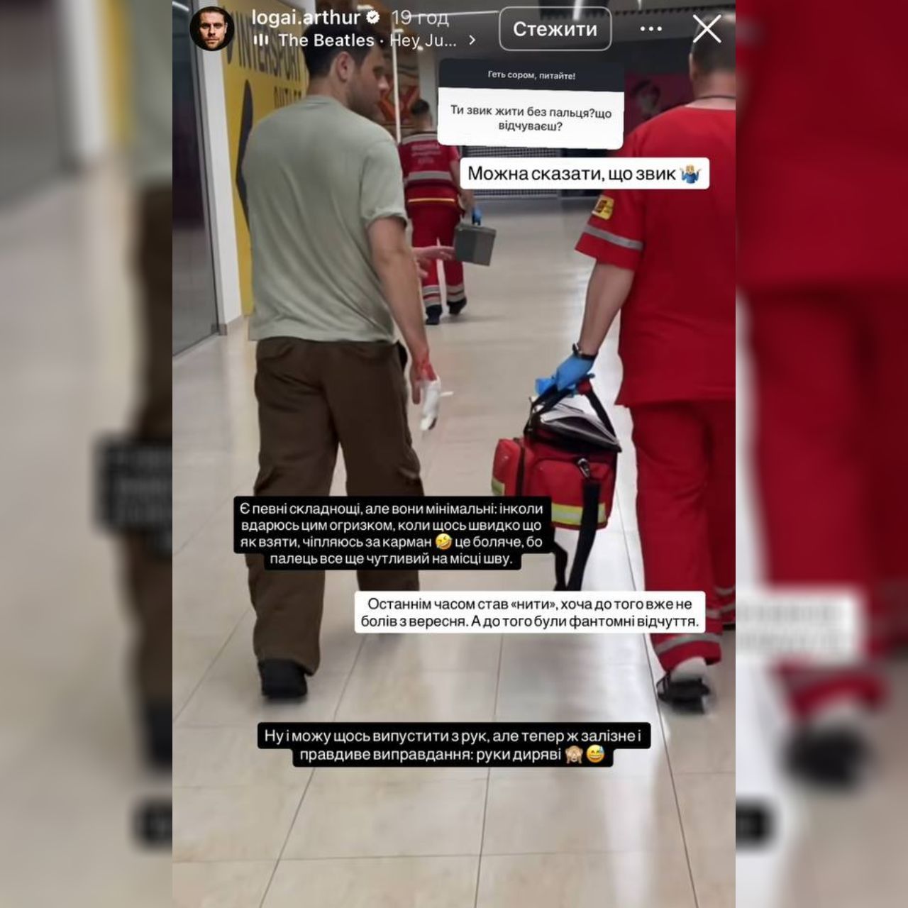 Можна сказати, що звик: Артур Логай розповів, як живе після втрати пальця Фото 1 Логай про травму